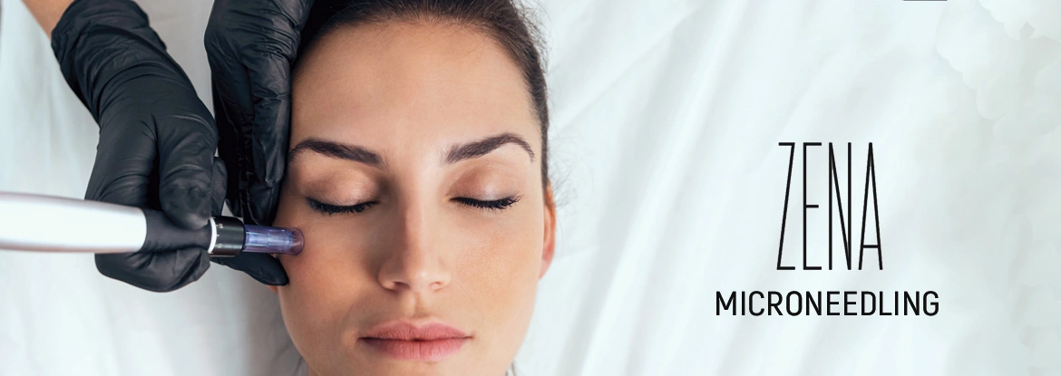 ZENA Microneedling in Moers. ck Kosmetik.